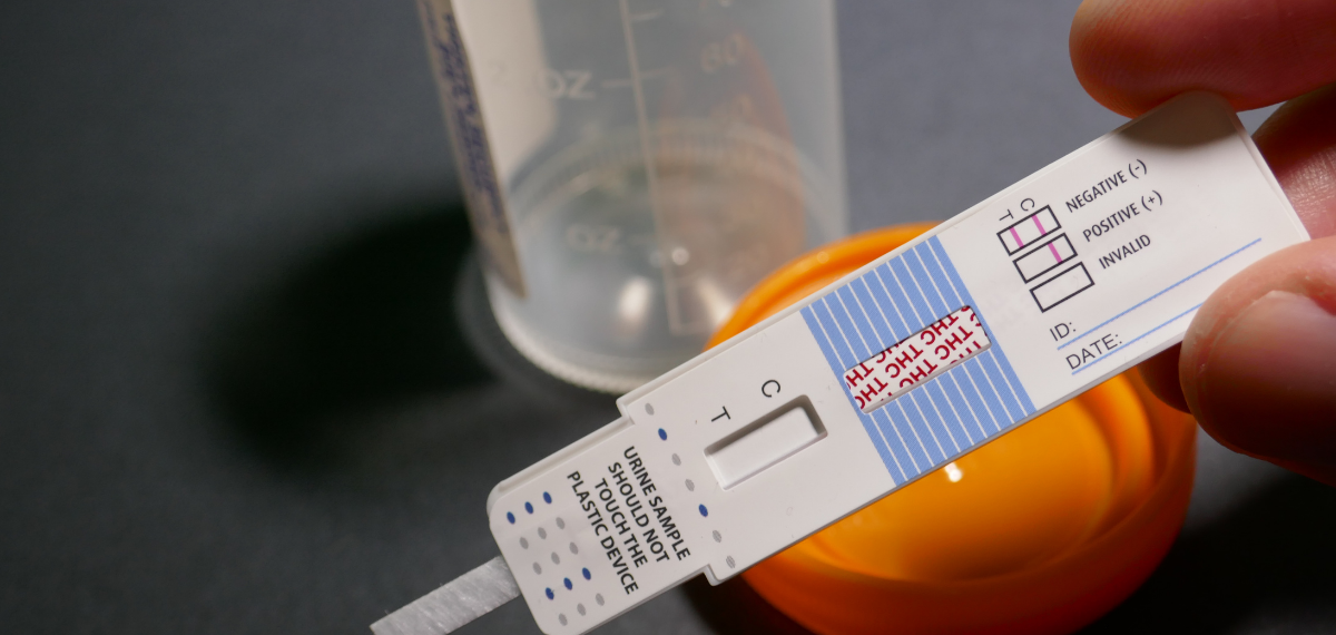 Conoce qué es toxicología y nuestras opciones de pruebas toxicológicas