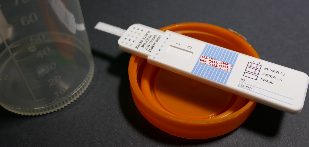 ¿como se llama el examen de orina para detectar drogas?