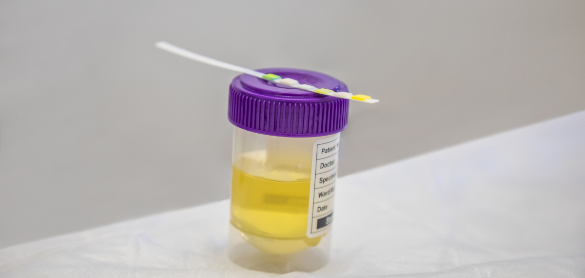 Prueba de drogas en orina en Hym Care